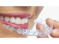 Елайнери - прозорі капи для вирівнювання зубів